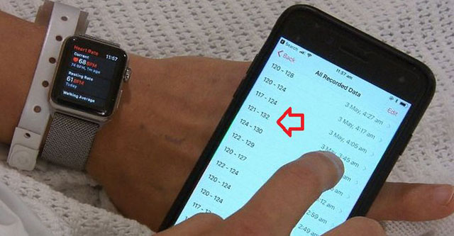Apple Watch tiếp tục cứu mạng chủ nhân bị bệnh tim