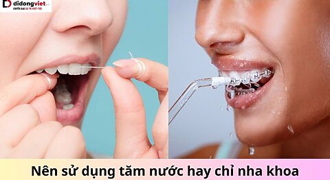 Nên sử dụng tăm nước hay chỉ nha khoa tốt hơn? Nên dùng tăm nước hay chỉ nha khoa