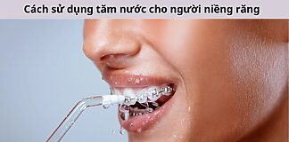 Cách dùng tăm nước cho người niềng răng