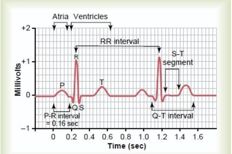 ecg la gi ung dung garmin ecg app co gi 10