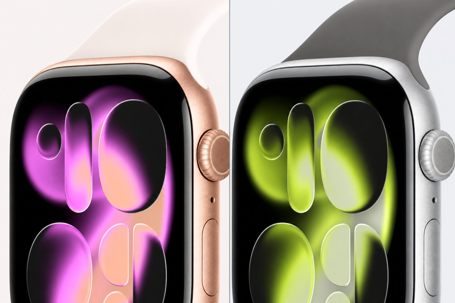 Apple Watch Series 11 có mấy màu? Hướng dẫn chọn màu phù hợp 7 Apple Watch Series 11 có mấy màu tông Vàng Hồng và Bạc